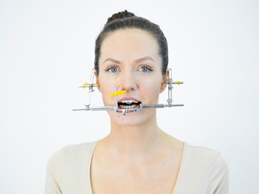 ®-CONDYLATOR® コンディレータ　フェイボウ Condylator
